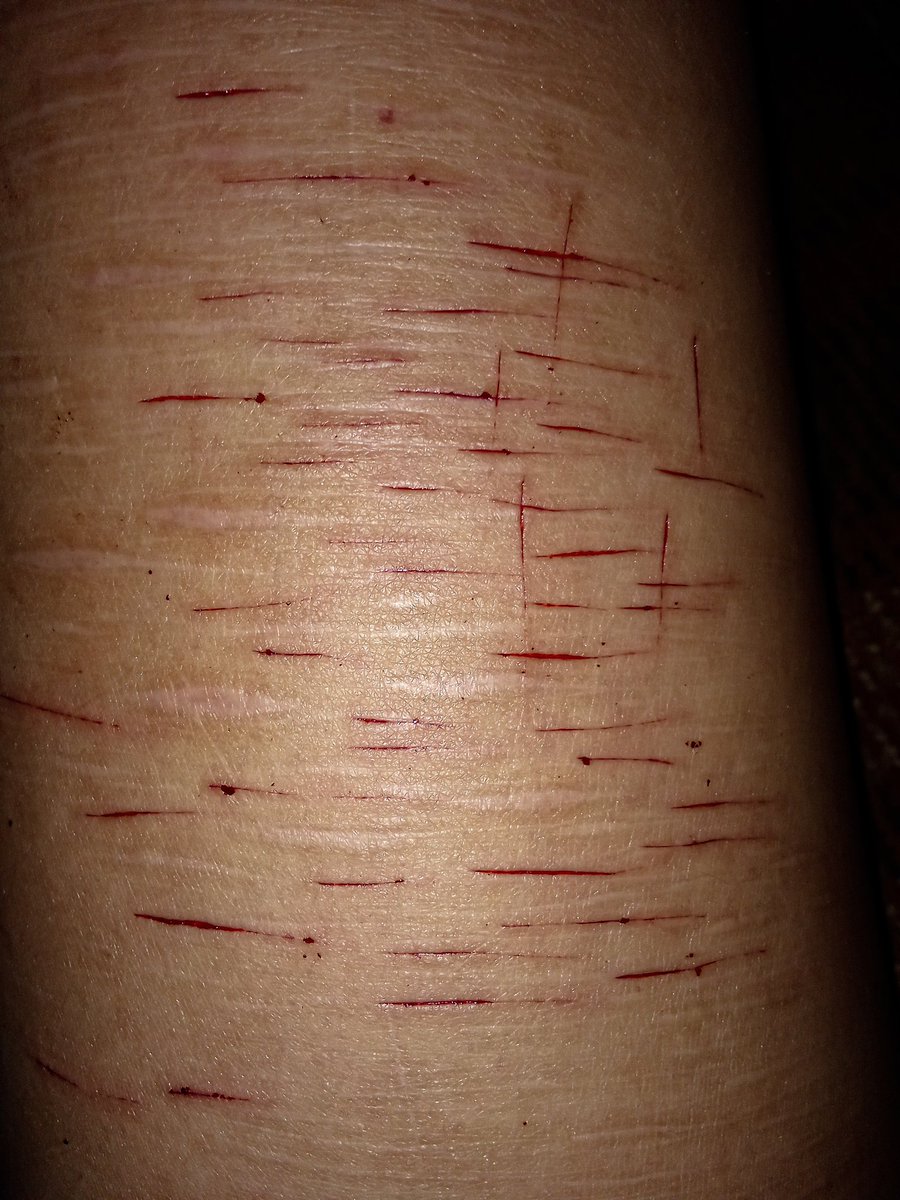 ⋆ conn. 🦇 tweet media