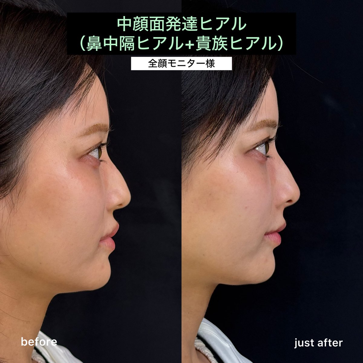 美容外科医さえら tweet media