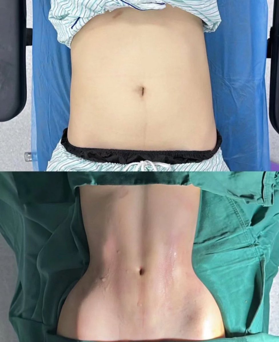 Elif ben tweet media