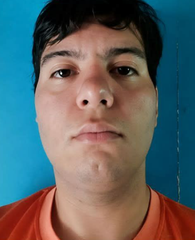 desaparecidaorg's tweet photo. Diego Matías Peralta tiene 23 años, desapareció el 2/4 en #Berazategui, Buenos Aires. Zona calle 142 A y Sevilla. Diego tiene T.E.A. y esquizofrenia. Vestía remera, bermuda, zapatillas negras y gorra. Por favor avisar #Urgente a la mamá (Érica)☎️11-6513-9216, o 911

#BuenosAires https://t.co/o5l4HhgoQb