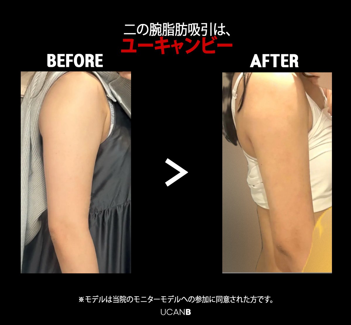 【公式】UcanB美容外科・皮膚科 tweet media
