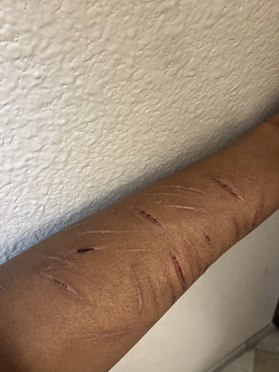 ivan of shtwt 🪴forced recov tweet media