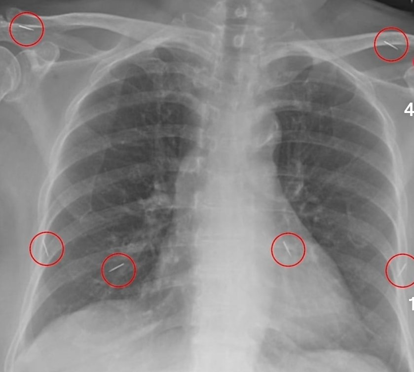 dr. Gia Pratama tweet media