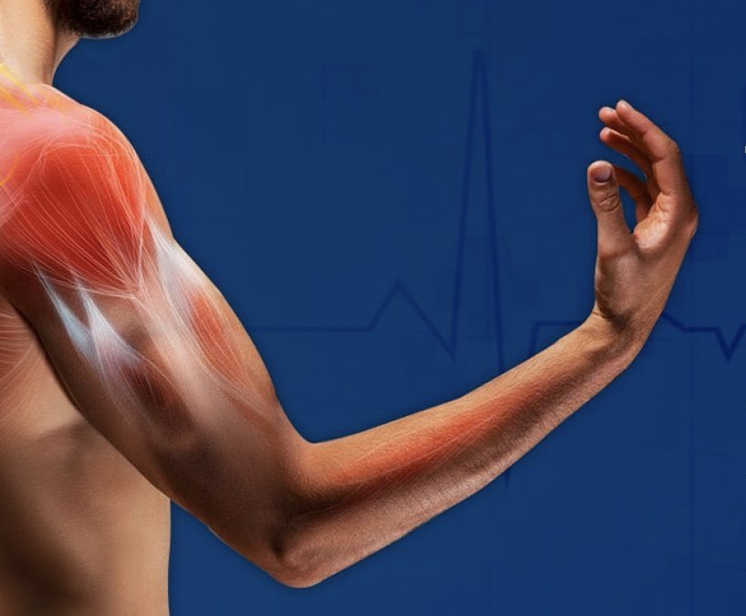 معظم حالات التهاب اوتار الكتف (Rotator Cuff) تُصاب بسبب الاستخدام المتكرر والمفرط للأوتار ( overuse ) وليس إصابة مباشرة .