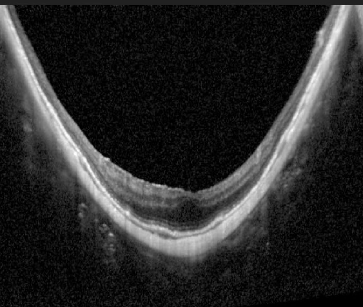 TheRetinaSociety tweet media