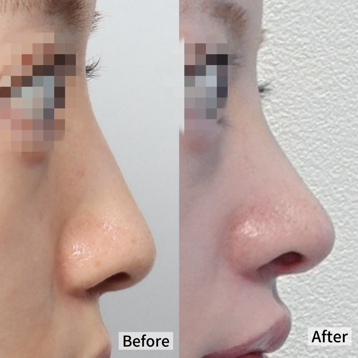 ミズキチ先生 tweet media