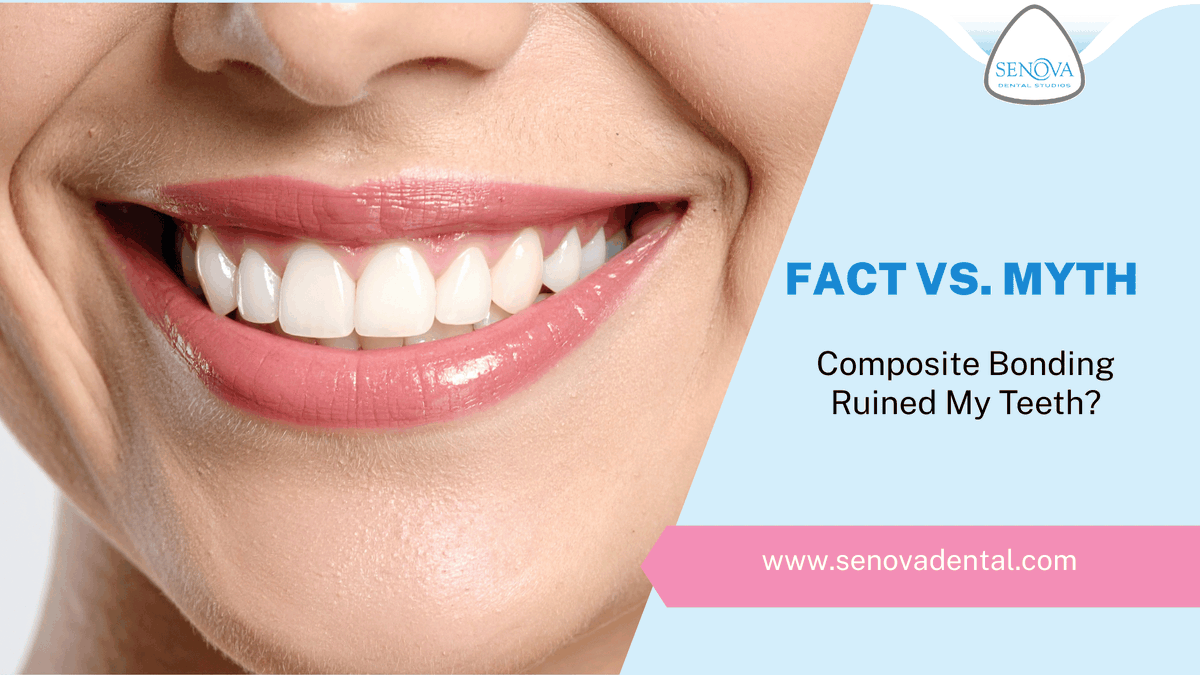 Fact Vs. Myth: Composite Bonding Ruined My Teeth? – Senova Blog senovadental.com/wordpress/fact…