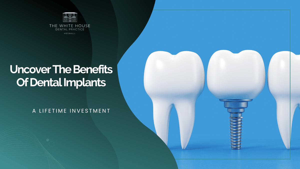 Uncover The Benefits Of Dental Implants: A Lifetime Investment – dental-implants-wirral.co.uk dental-implants-wirral.co.uk/uncover-the-be…