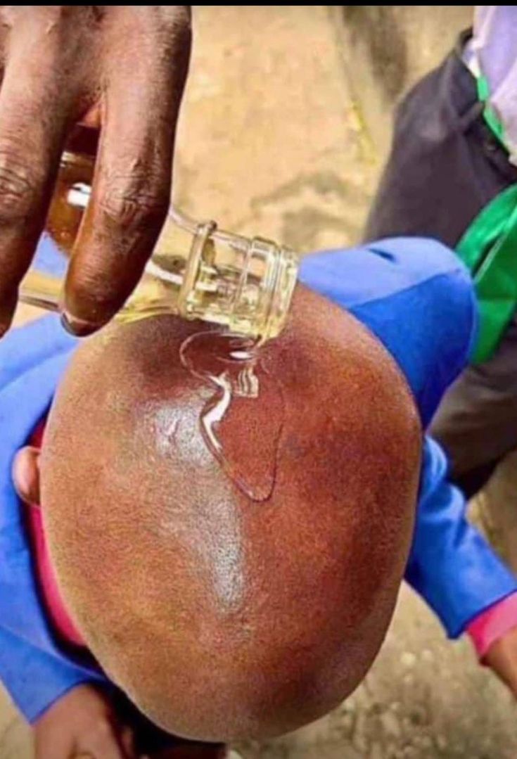 Blackoo! tweet media