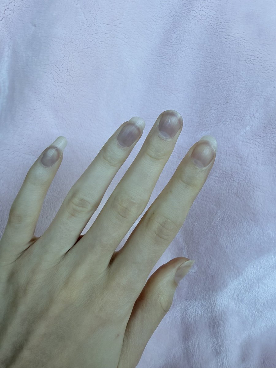 ⋆˚࿔ anie𝜗𝜚˚⋆ tweet media