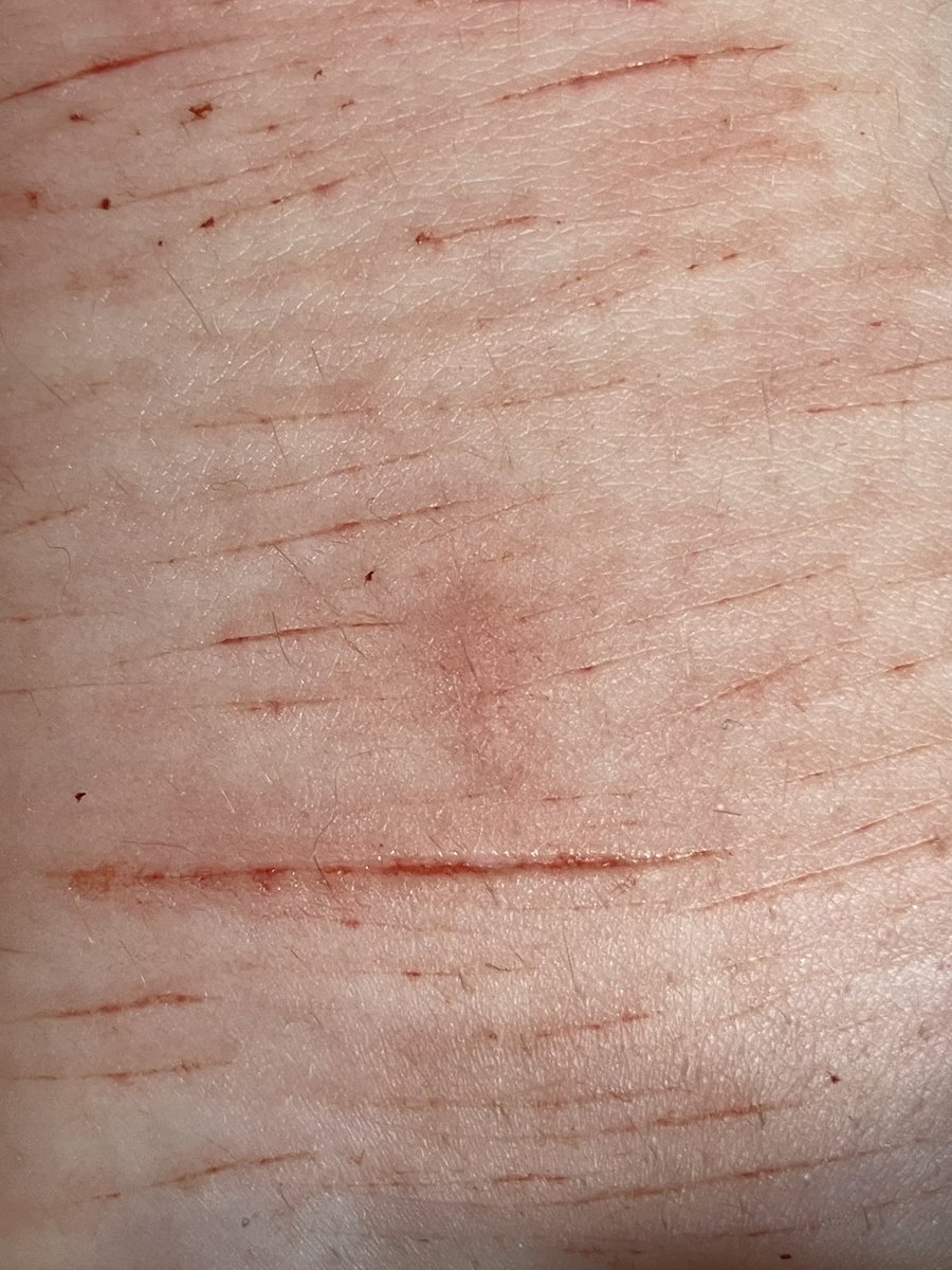 ♯💥𝐻𝑒𝑛𝑟𝑦 𝐵𝑜𝑤𝑒𝑟𝑠 𝑜𝑓 𝑠ℎ𝑡𝑤𝑡🔥ꨄ︎ tweet media