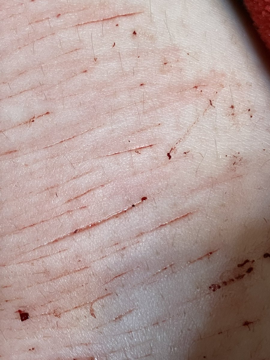 ♯💥𝐻𝑒𝑛𝑟𝑦 𝐵𝑜𝑤𝑒𝑟𝑠 𝑜𝑓 𝑠ℎ𝑡𝑤𝑡🔥ꨄ︎ tweet media