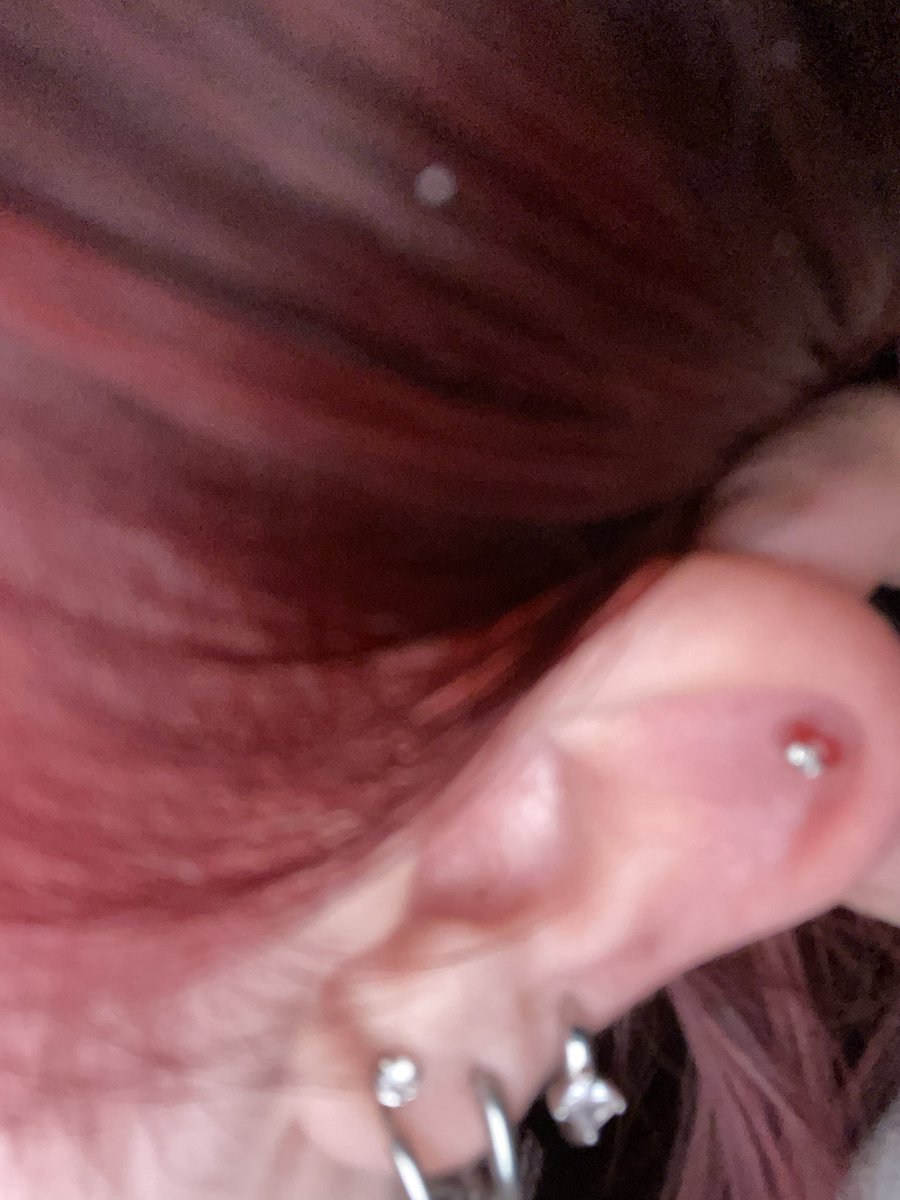 𝖿𝖾𝗋𝗇 tweet media