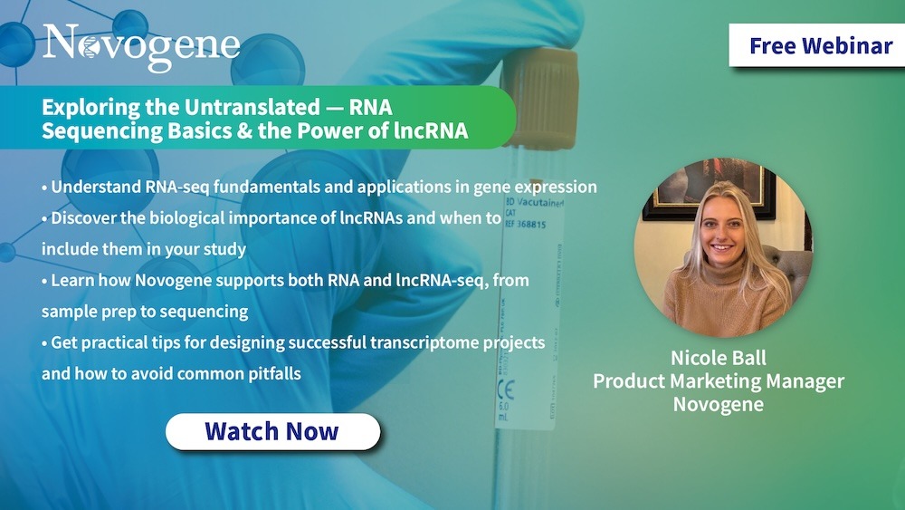 Novogene_Europe's tweet image. Watch Novogene's free, on-demand webinar: Exploring the Untranslated: RNA Sequencing Basics &amp;amp; the Power of lncRNA. Learn library prep, sequencing strategies &amp;amp; downstream lncRNA analyses. #Transcriptomics #lncRNA #RNAseq tinyurl.com/n9s6mzew