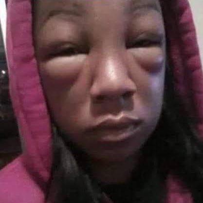 mer , cms dm tweet media