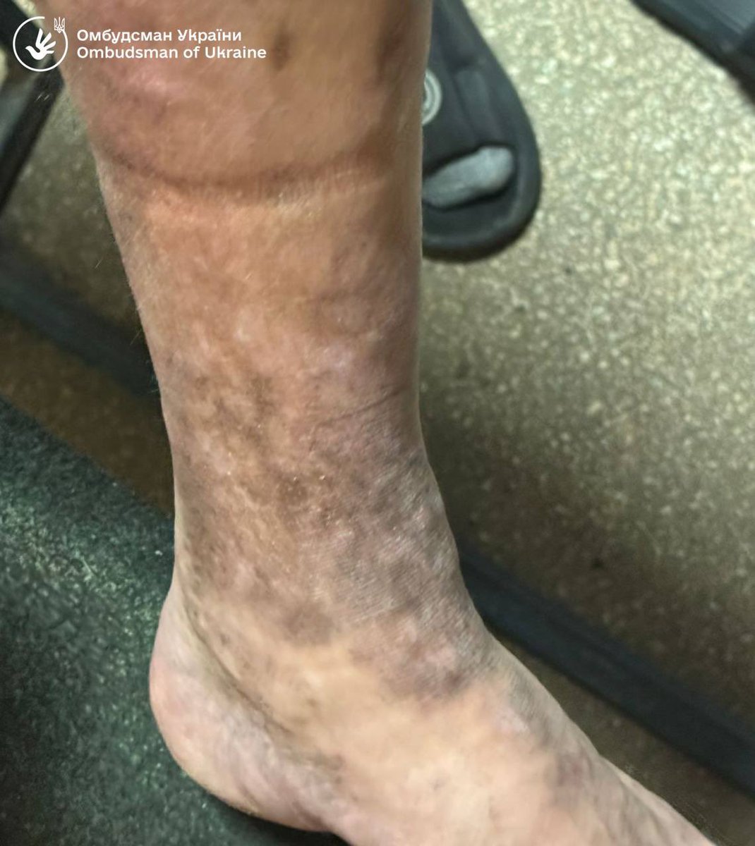 Myroslav Oleshko tweet media