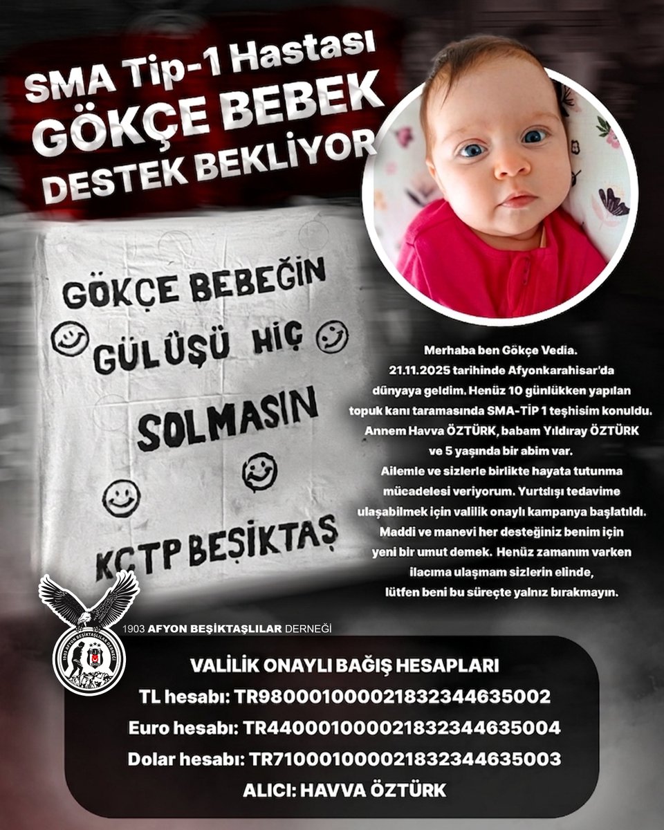Gökçe Bebek İçin Umut Olalım! 🕊️

Afyonkarahisar’da dünyaya gelen Gökçe Vedia, henüz yolun çok başında SMA Tip-1 hastalığı ile mücadele ediyor. Onun gülüşünün hiç solmaması, yaşıtları gibi koşup oynaması bizim elimizde.

instagram.com/sma.gokcevedia…
<a href="/carsivicdan_/">çArşı vicdan</a> <a href="/forzabesiktas/">çArşı</a>