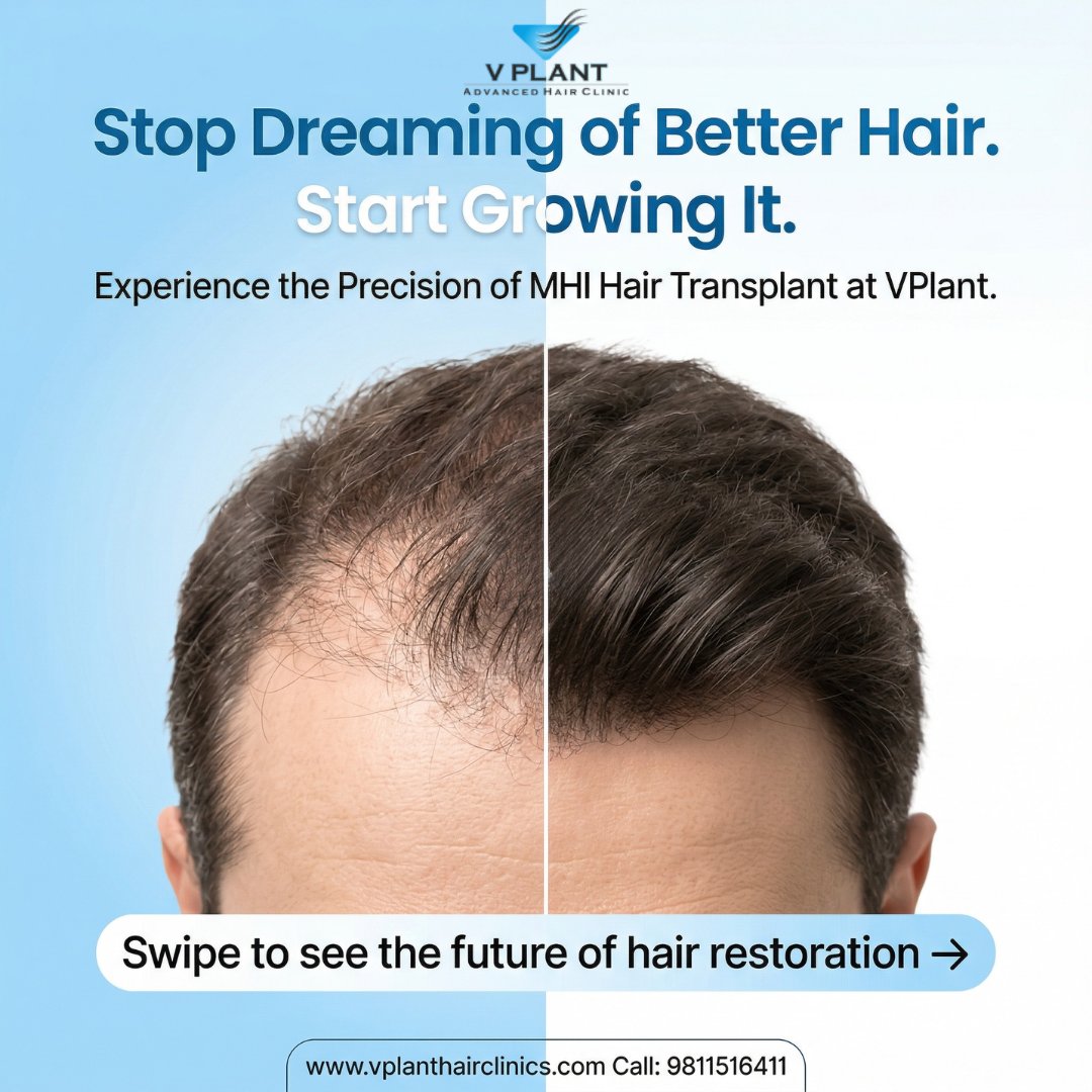 VplantClinics's tweet photo. Stop Dreaming of Better Hair. Start Growing It! 🚀
Are you tired of seeing more hair in the brush than on your head? It’s time to move beyond temporary fixes and experience the future of hair restoration.

#HairTransplantMumbai #HairTransplantDelhi #VPlantClinic https://t.co/vDpB4lOqyI