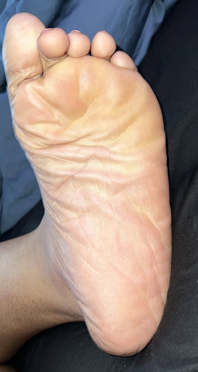 Feet_Feet13's tweet photo. Good morning 
Kiss my big wrinkly sole 😘👣

https://t.co/OTgtqvKzxz https://t.co/9si3ZDPuKS
