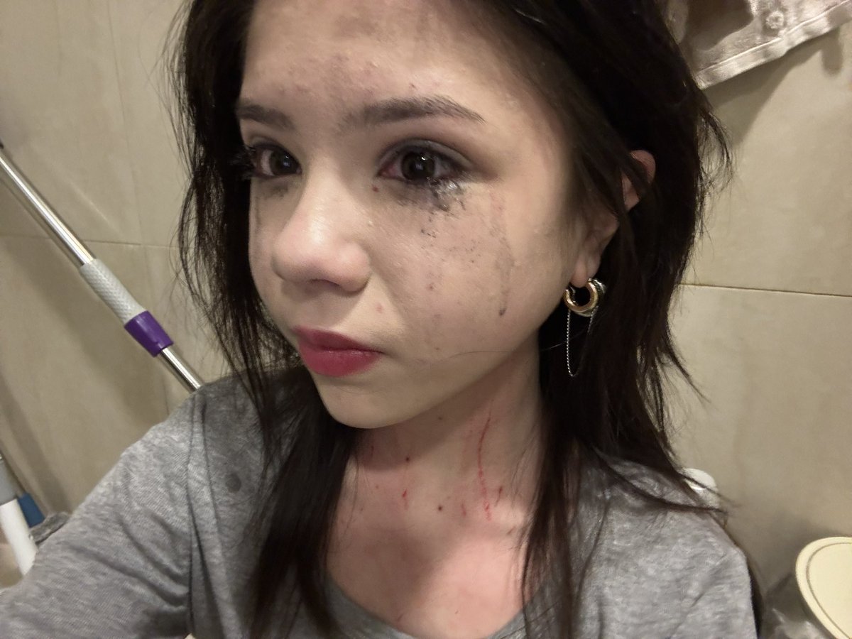 ༺✧ 𝘼𝙡𝙩𝙝𝙚𝙣𝙖 !/ ✧༻🍹🏥 tweet media