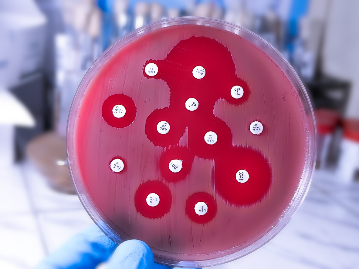MicrobioSoc's tweet photo. 𧬠Effective AMR action needs joined-up surveillance.
This workshop report outlines priorities for a UK National One Health AMR surveillance system.
π https://t.co/jxAVZirCY9
#KOAMR #KnockingOutAMR #OneHealth https://t.co/4QjY0M9lhN
