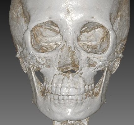 整形OL ロビたん tweet media