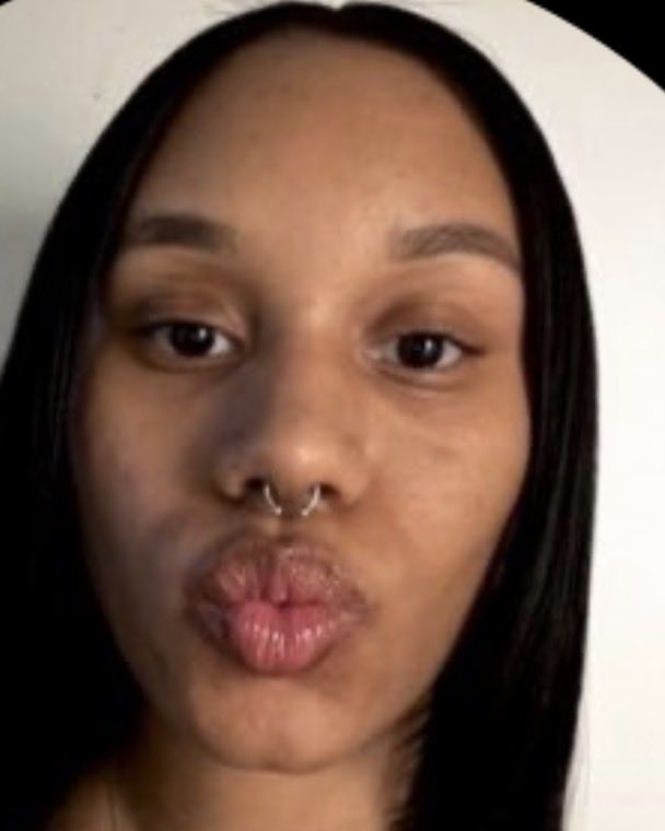 fightsforus tweet media