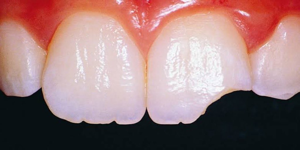 DAMI FOREIGN🥶 tweet media