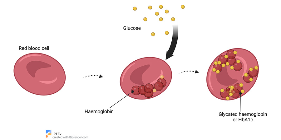 PathologyTests's tweet photo. HbA1c is a simple blood test that shows your average blood glucose over the past 2-3 months. It’s used to help diagnose and monitor type 2 diabetes, and there’s usually no preparation needed before the test.
https://t.co/S9RuQOnUoa
#HbA1c #DiabetesAwareness #Type2Diabetes https://t.co/dppHfUU0ax
