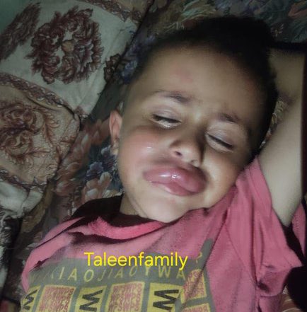 Taleen Family 🍉 tweet media