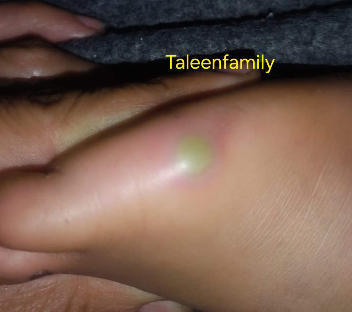 Taleen Family 🍉 tweet media