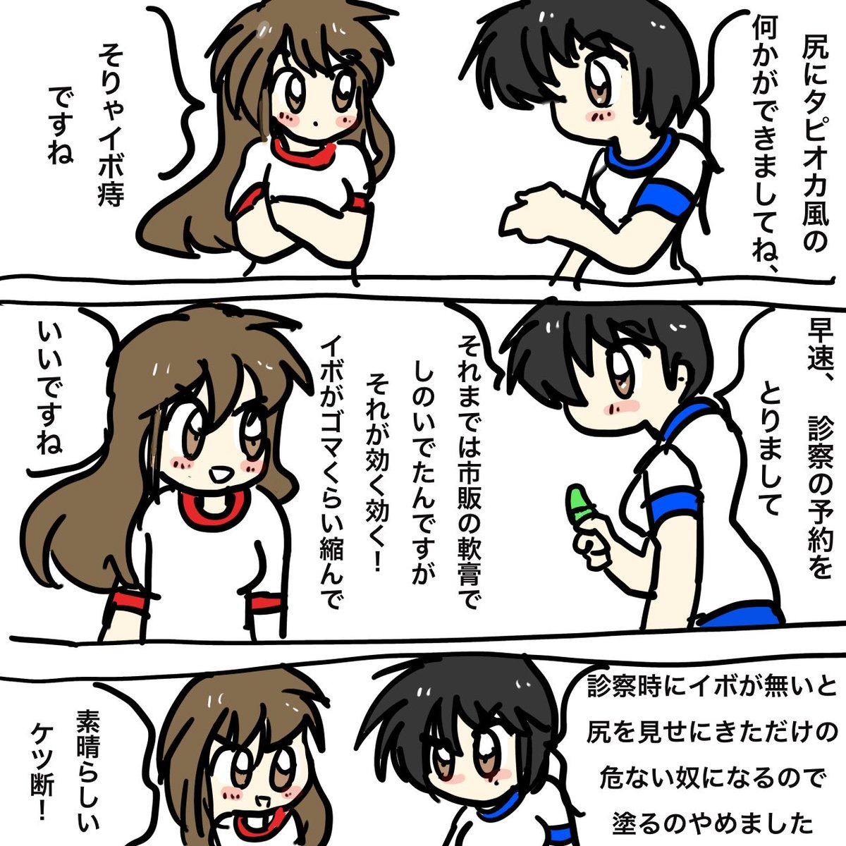 イボ痔の治療してきました。 