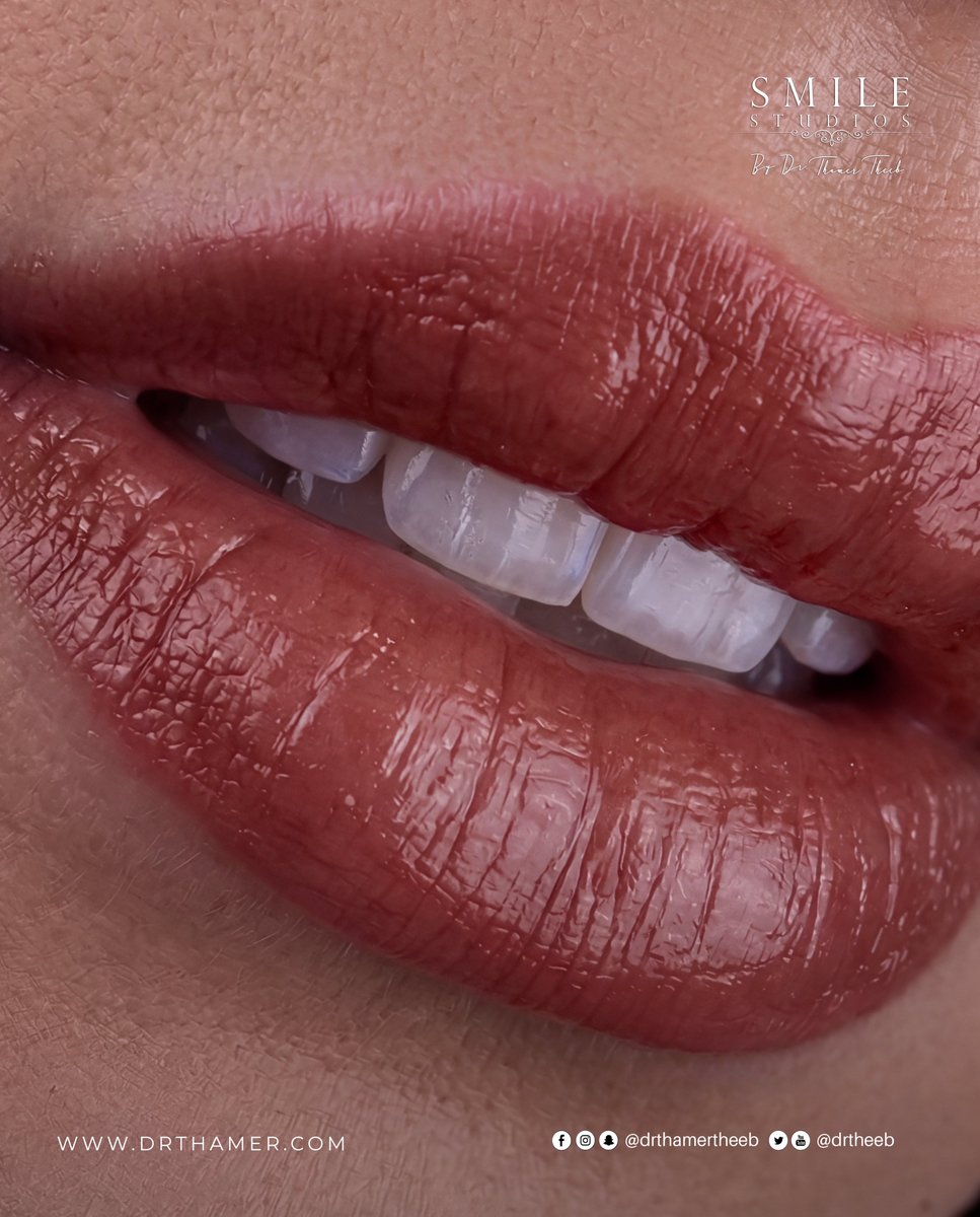 drtheeb's tweet photo. لأن ابتسامتك هي أول ما يُرى… اجعلها لا تُنسى
Your Smile, Redefined in Luxury — By Dr. Thamer Theeb

#DrThamerTheeb #SmileStudios #YourSmile
#ابتسامتك #عيادة_الأسنان_عمان https://t.co/G6Mskes4sO