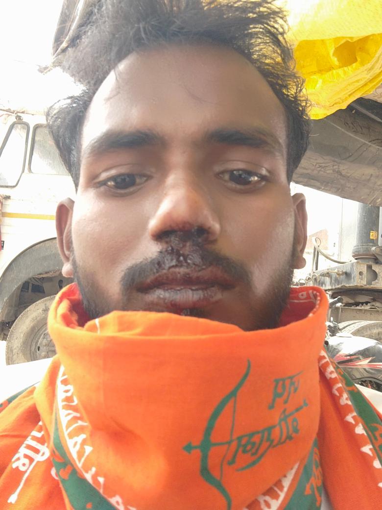 माननीय जिलाधिकारी महोदय कार्रवाई करने की कृपा करें।
रेउसा थाना के अंतर्गत बजरंगी को मारा पीटा गया है। 
<a href="/myogioffice/">Yogi Adityanath Office</a> <a href="/dm_sitapur/">DM Sitapur</a> <a href="/sitapurpolice/">Sitapur Police</a>