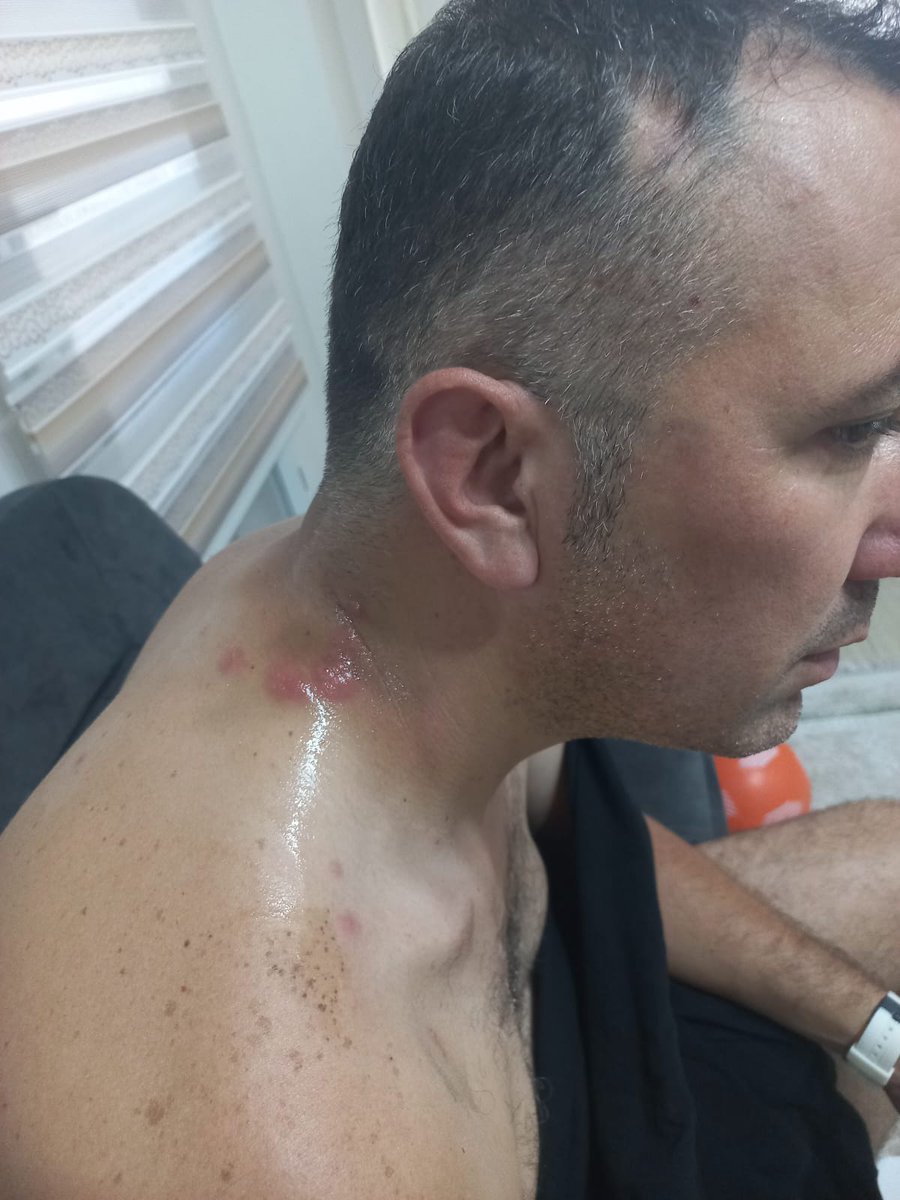 Vedat KILIÇEL (BOMBACI) tweet media