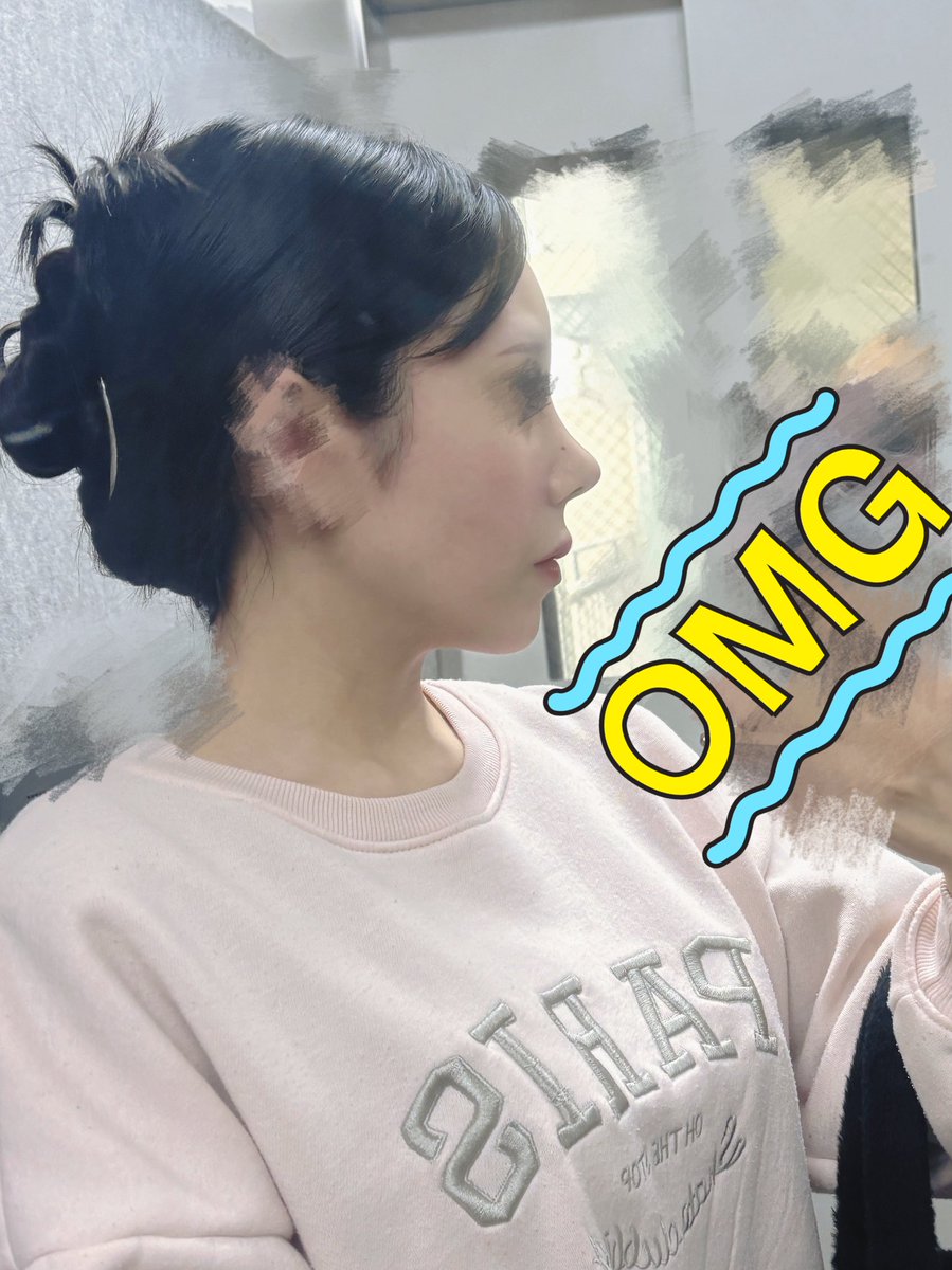 R🎀鼻フルDT tweet media