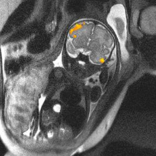 Clarion de Laffalot tweet media