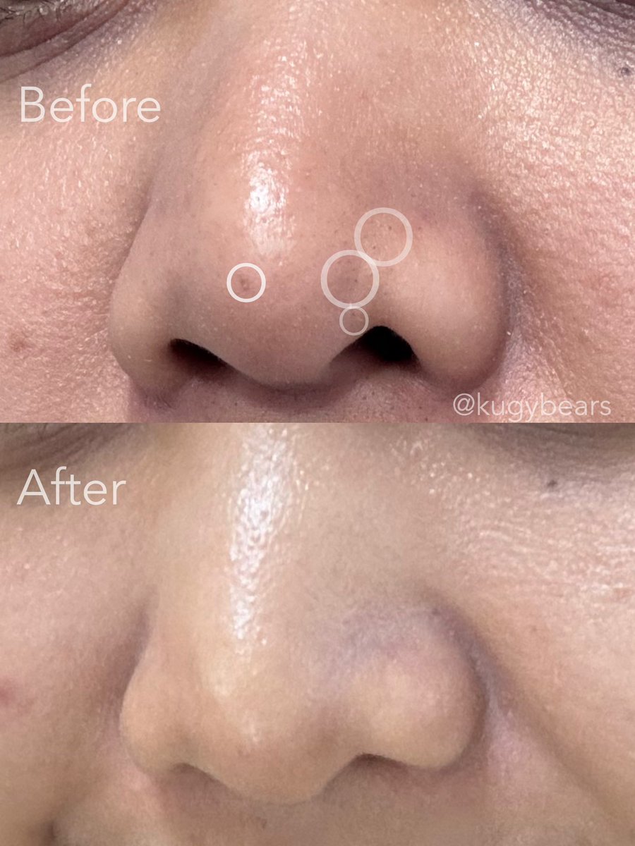 kugy🌸 tweet media