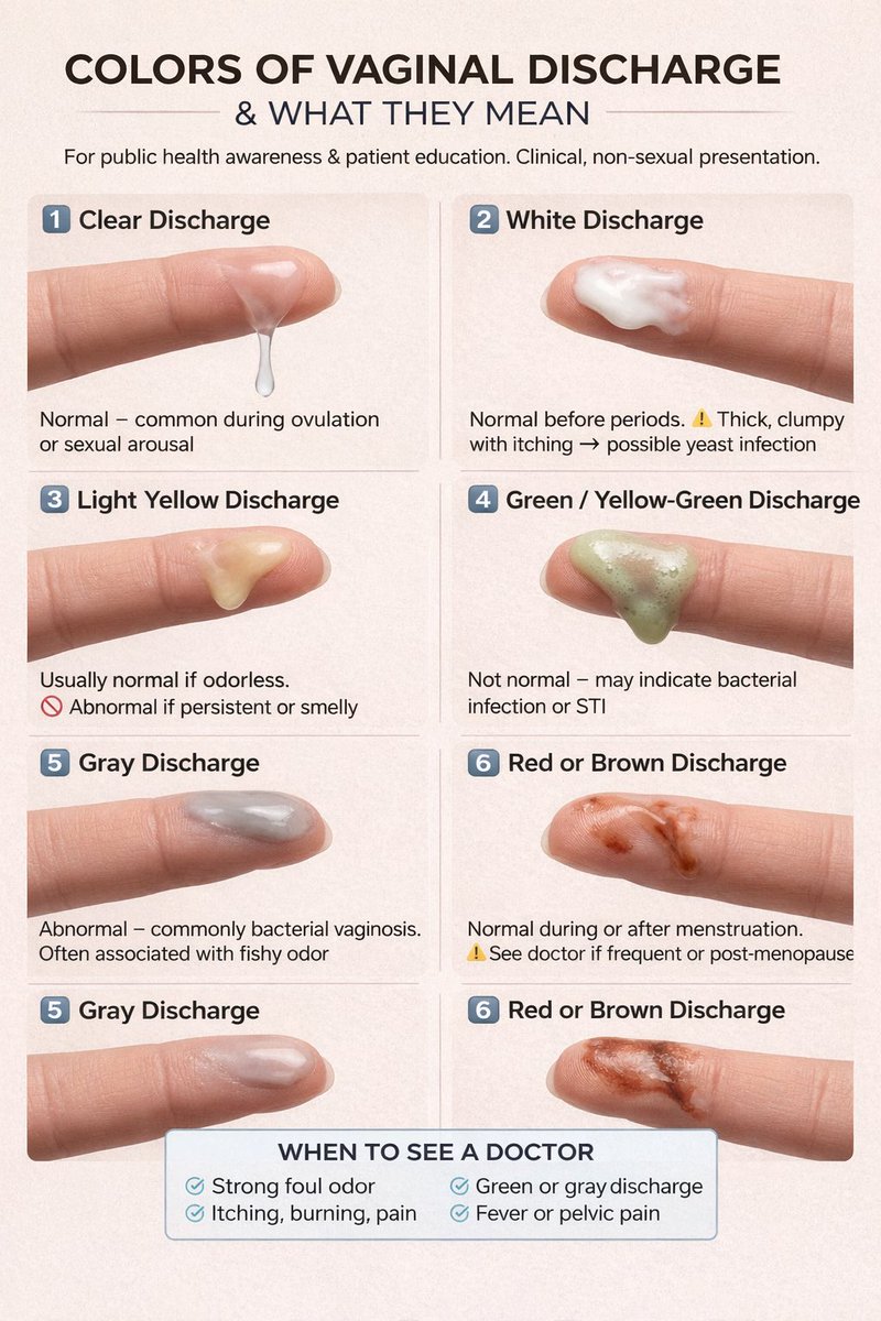 TMedicalpost's tweet photo. Types of Vaginal Discharge &amp; What They Mean https://t.co/BdAYmOREcp