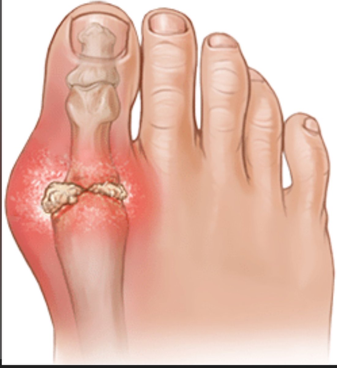 Medpulse🩺 tweet media