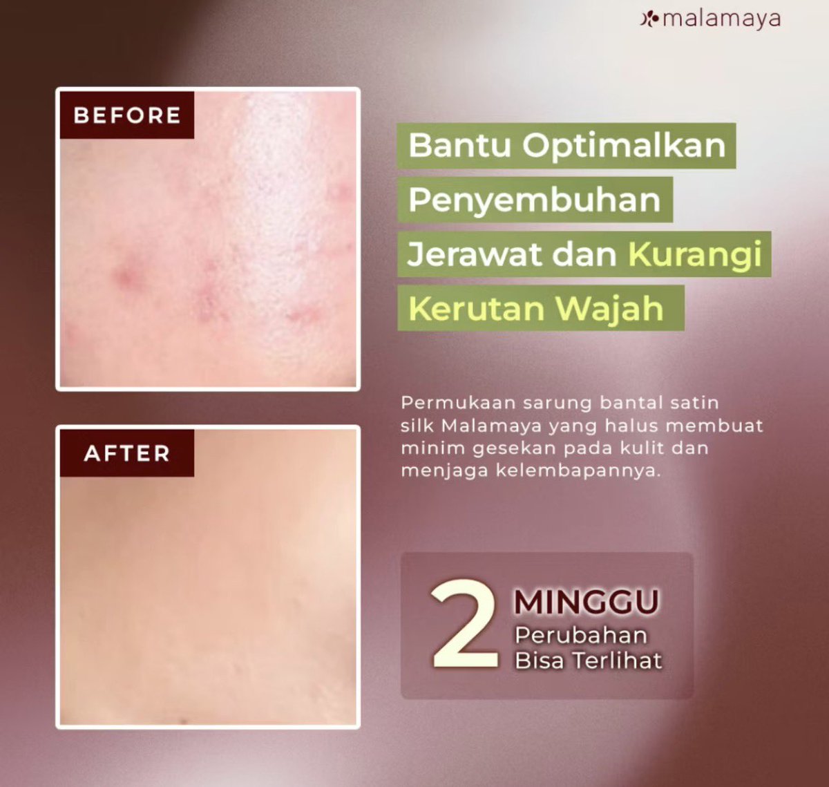 theliilkit's tweet photo. Jujur bagus banget dan wajib minimal punya 1 sih😭❤️ 

https://t.co/eww5NON2U5 https://t.co/4wg6MKEgaZ