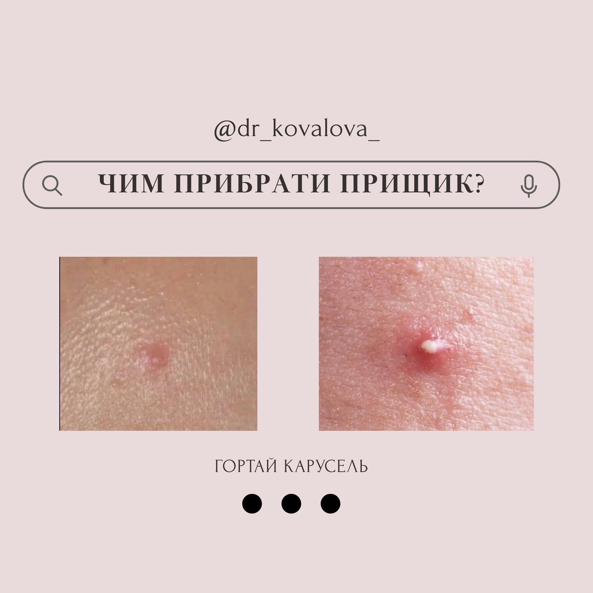 Дерматолог Ірина tweet media