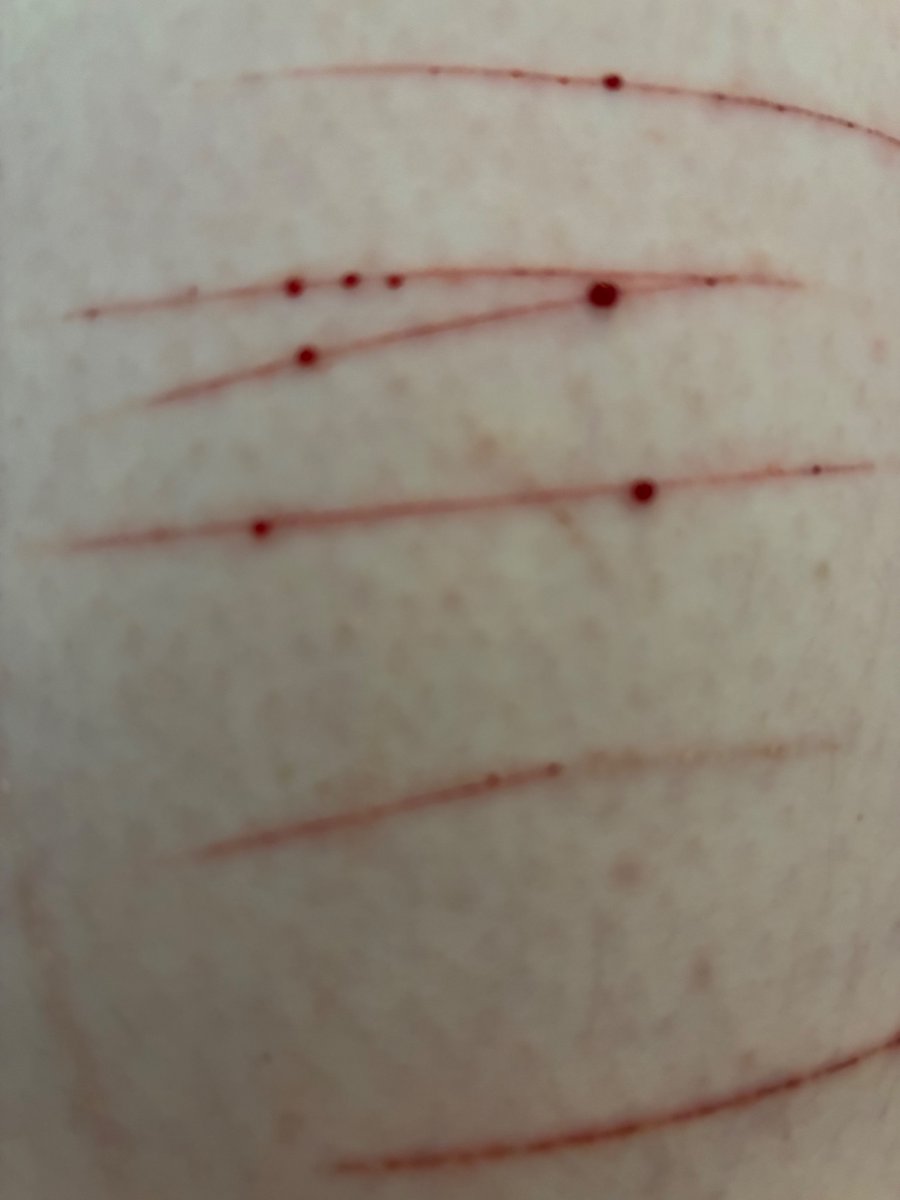 ST☆R ‧₊˚ ┊#shedtwt tweet media