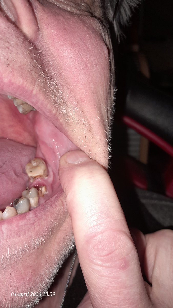 F1 Dutch 🇳🇱 🇺🇦 tweet media