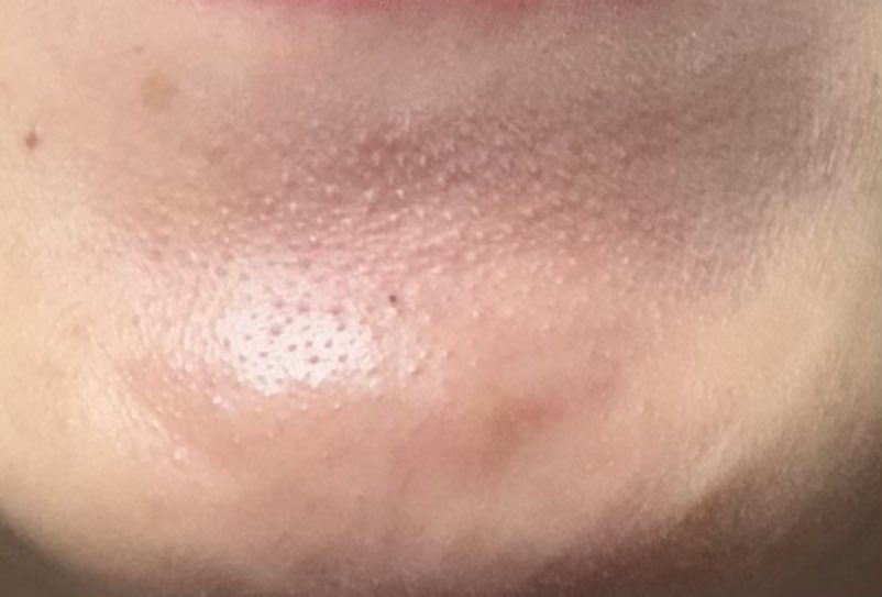 醜人（しこんちゅ） tweet media