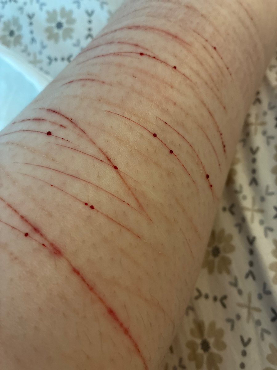 ST☆R ‧₊˚ ┊#shedtwt tweet media