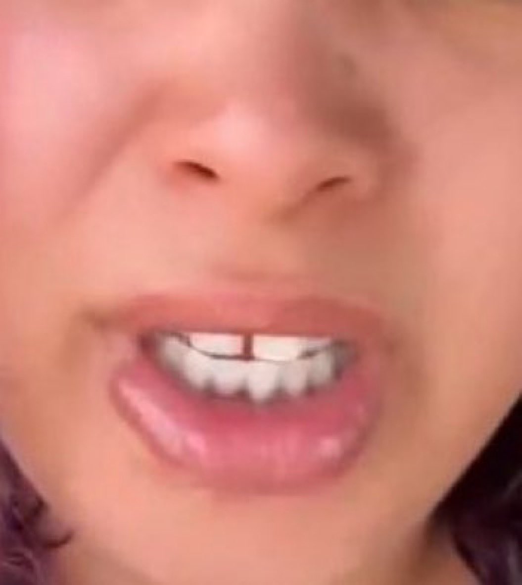 Retarded Mutant tweet media