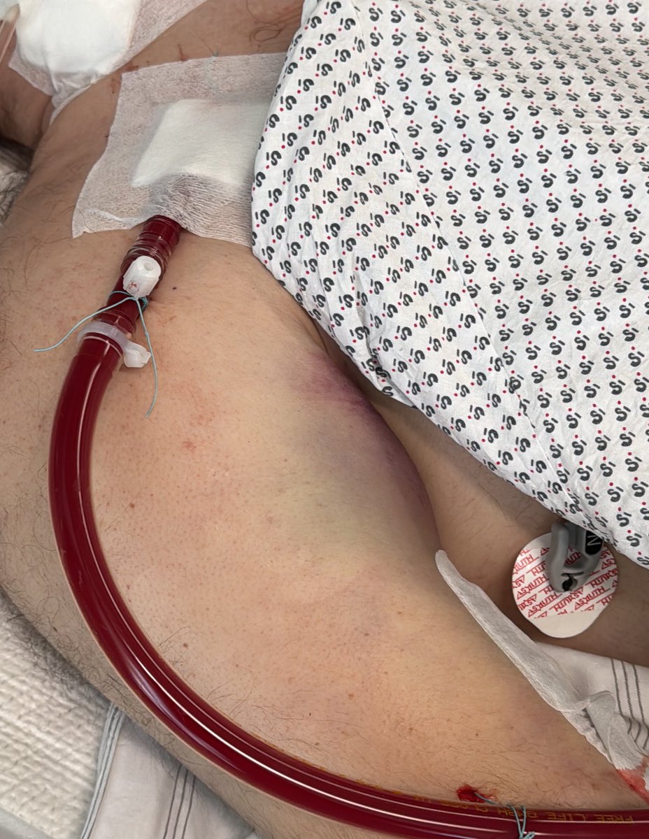 ECMO_Doc tweet media