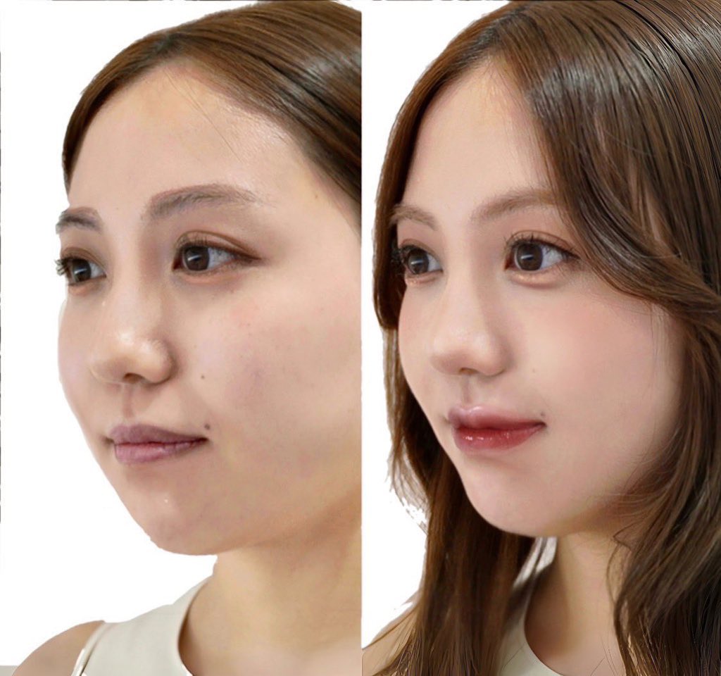 メゾンカラクル / Máison Colorcle tweet media