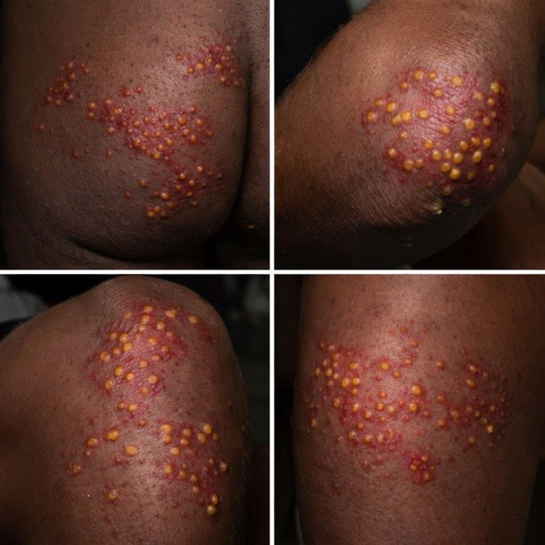 Victoria A tweet media